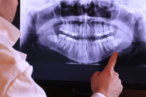 Best Emergency TMJ Treatment in Milford, NE