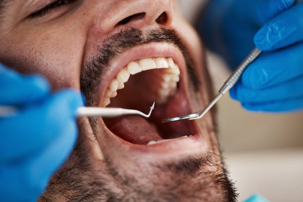 Best Emergency Denture Repair in Milford, NE